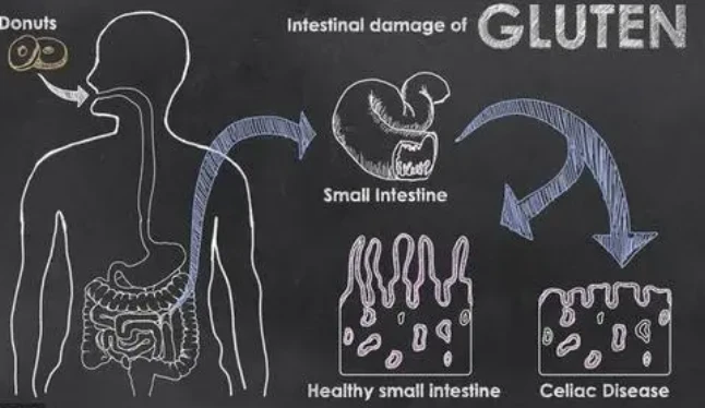 1 1